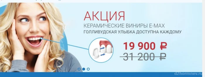 Керамические виниры Е-max за 19000 руб. вместо 31200 руб.